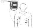 Elektrody-M-&-B-AED-7000-2.jpg