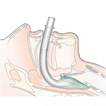 Zakładanie maski krtaniowej IGEL u dorosłych i dzieci.